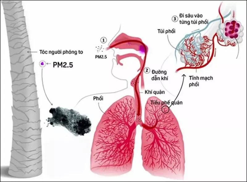 Bụi mịn là gì? Cách hạn chế bụi mịn trong không khí hiệu quả