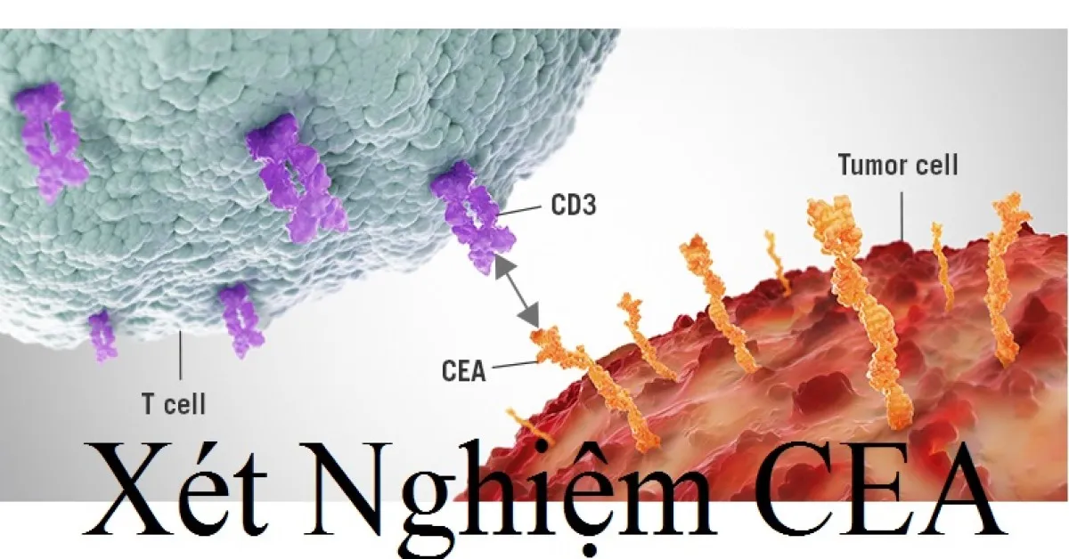 Chỉ số CEA là gì? Ý nghĩa của xét nghiệm CEA