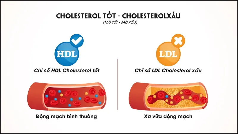 Chỉ số HDL – Cholesterol là gì? Cách cải thiện HDL – Cholesterol trong máu mà bạn nên biết