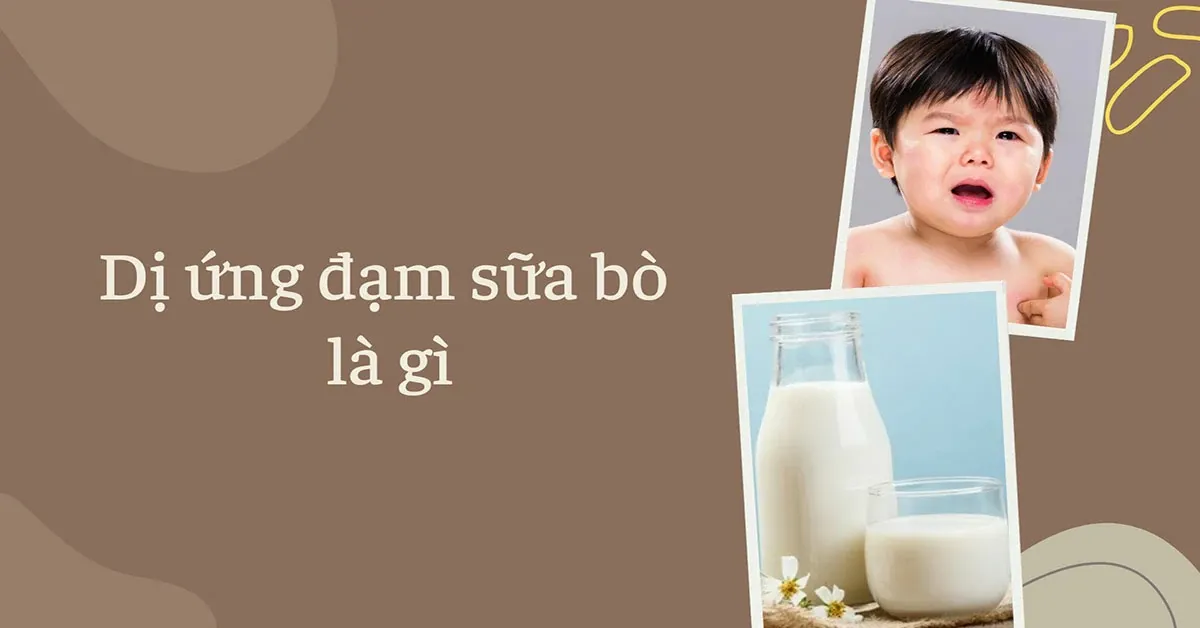 Dị ứng đạm sữa bò là gì? Dấu hiệu nhận biết dị ứng sữa bò ở trẻ?