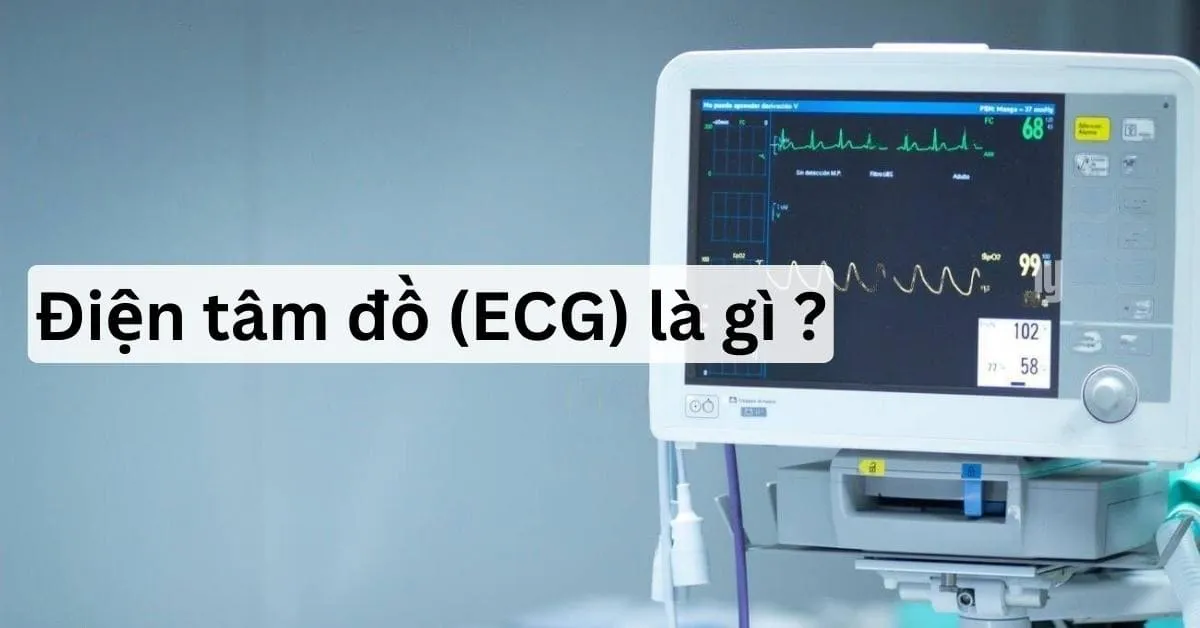 ECG là gì? Công dụng và tầm quan trọng của ECG bạn nên biết