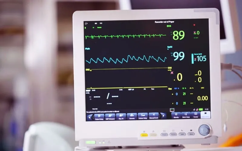 ECG là gì? Công dụng và tầm quan trọng của ECG bạn nên biết