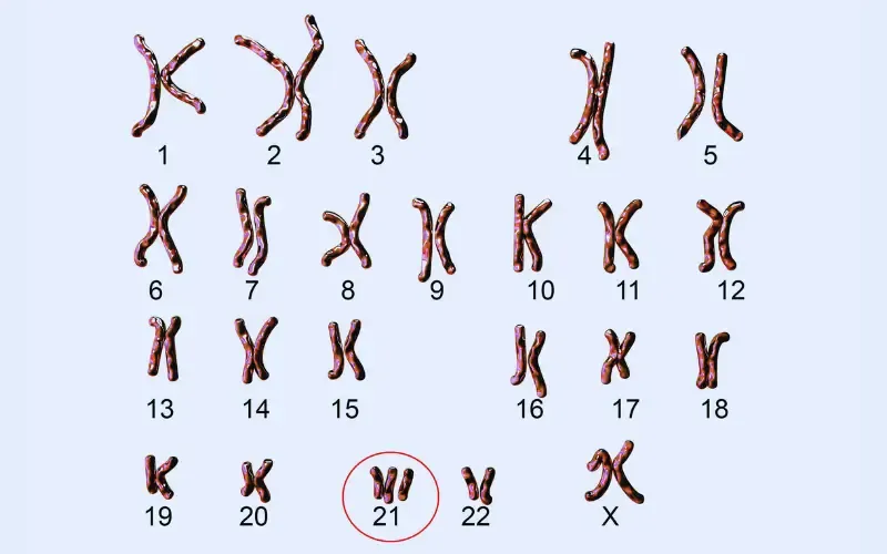 Lịch sử, hoạt động tưởng niệm ngày Hội chứng Down thế giới