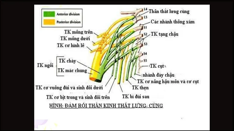 Mô tả đám rối thần kinh thắt lưng: Khái niệm, triệu chứng, chẩn đoán và điều trị