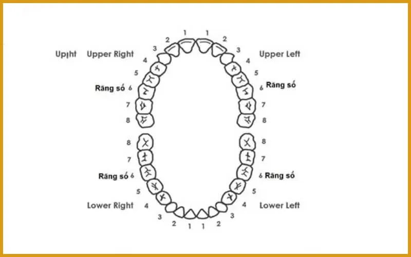 Răng khôn là gì? Các lưu ý về nhổ răng khôn mà bạn cần biết