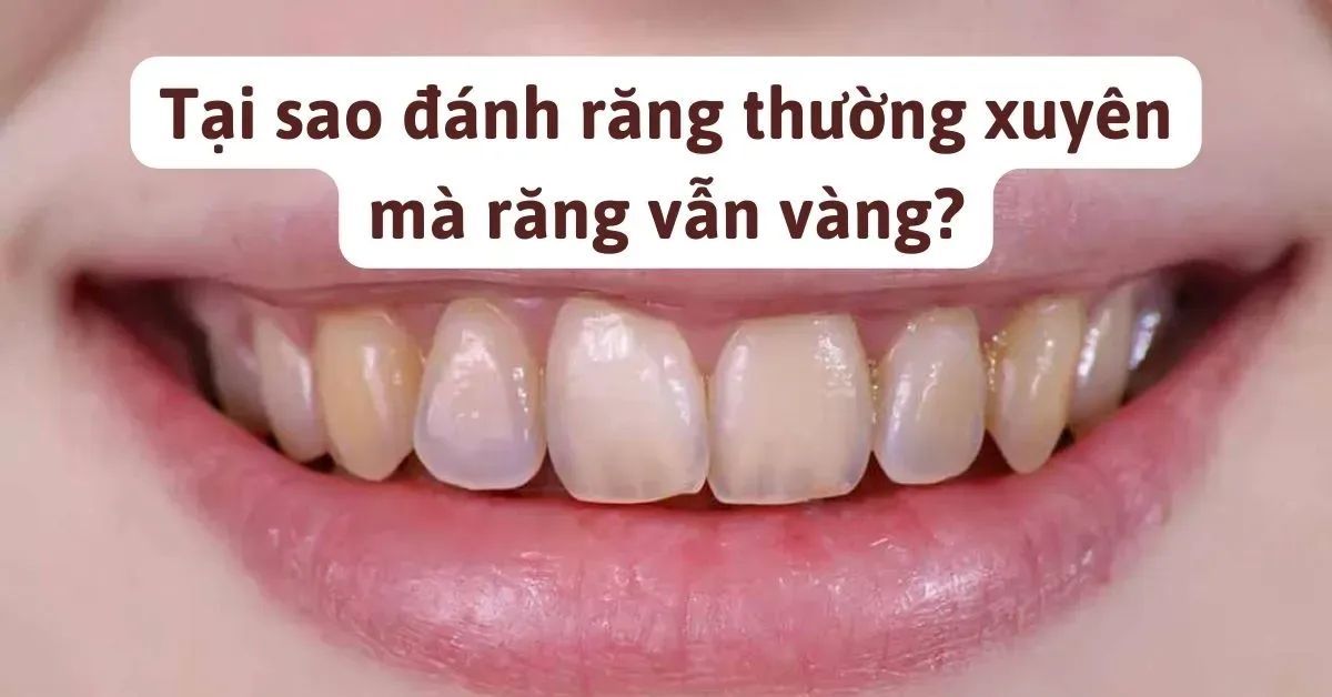 Tại sao đánh răng thường xuyên mà răng vẫn vàng? 8 cách làm trắng răng tại nhà