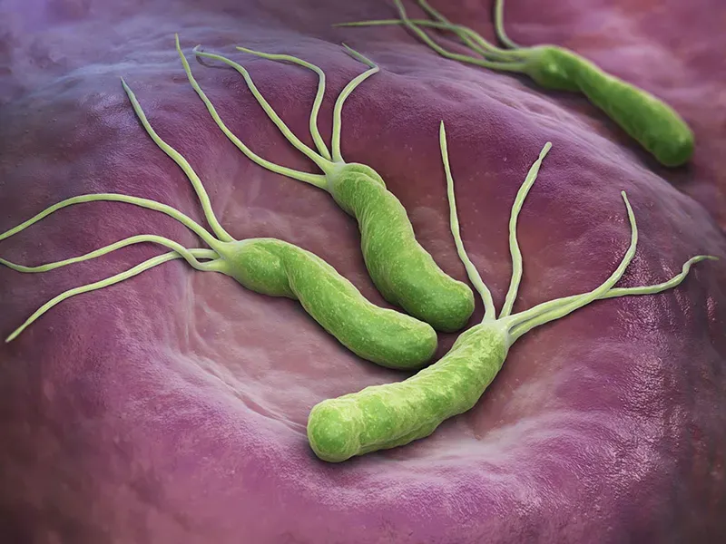 Vi khuẩn HP (H.pylori) là gì? Nguyên nhân gây bệnh về dạ dày